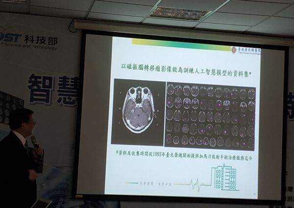 臺大、北榮、北醫三團隊展示AI輔助診斷系統，大幅縮短心、腦、肺重大疾病診斷時間-AI輔助診斷系統