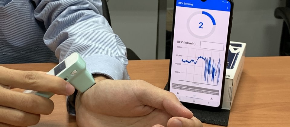 交大團隊研發一款手持非侵入式AI血流量測裝置,可協助洗腎病患量測瘻管狀態,以檢測是否阻塞。