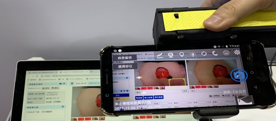 只要以手機搭配熱感影像儀器拍攝傷口照片,後臺AI系統即可自動圈出傷口範圍、計算面積,提供醫生參考資訊。未來,工研院還要打造傷口深度AI模型,讓醫生有更多資訊來決定治療方法和敷料選擇。